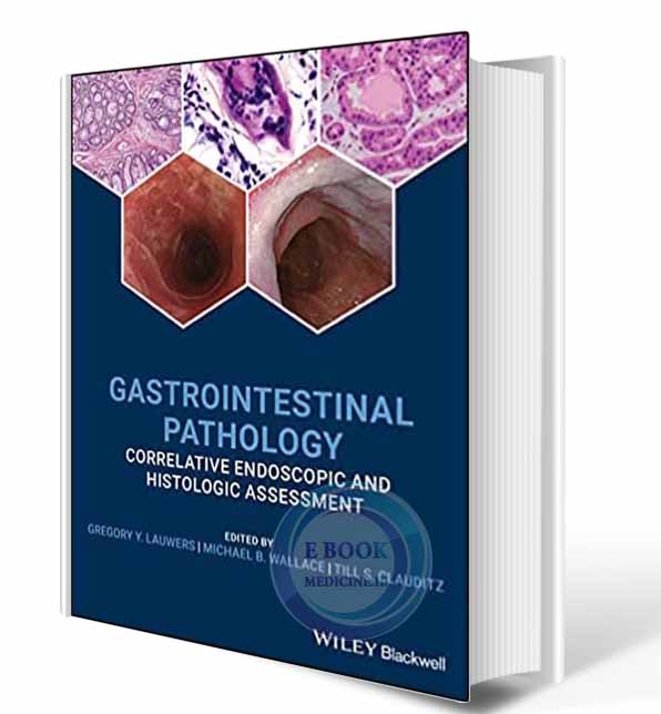 دانلود کتاب Gastrointestinal Pathology: Correlative Endoscopic and Histologic Assessment Hardcover  2021 (ORIGINAL PDF) 